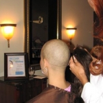 Hair loss due to chemotherapy